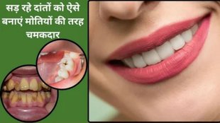 Remedies to remove yellow plaque from teeth, home remedies to whiten yellow teeth, remedies for teeth whitening, remedies to strengthen teeth and heart