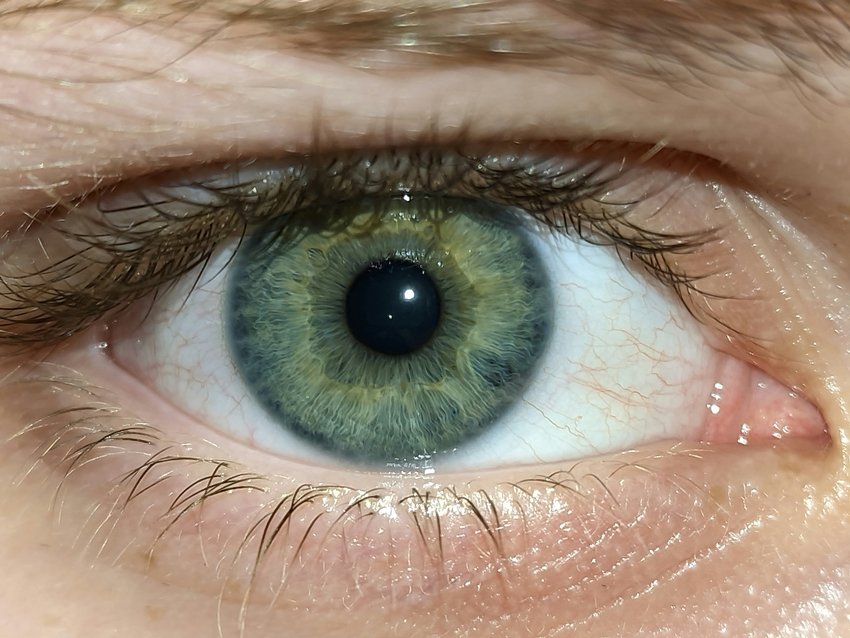 Best Foods and Habits to Prevent Dry Eyes Naturally