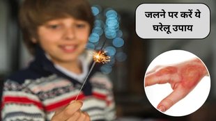 First Aid Treatment for Fireworks Burns, Fireworks Burns and Injuries during diwali, how to burn skin during diwali, First Aid for Burn
