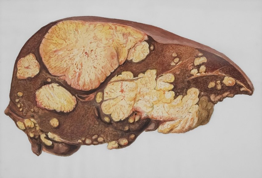 Hepatologist