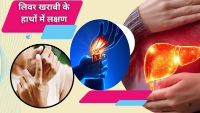 लिवर में खराबी होने पर हाथों में दिखाई देते हैं ये 5 संकेत, तुरंत करें पहचान, जानिए कैसे