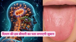neurone disease,AI and healthcare,ALS,als diagnosis,ALS disease,ALS disease research,ALS study,ALS research,als symptoms,Motor Neurone Disease (MND),