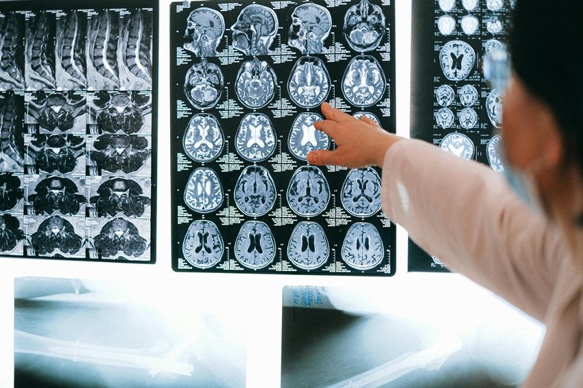 Neurologist