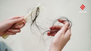 Reduce hair fall naturally