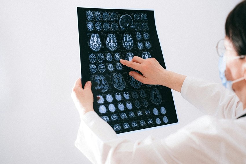 Scientists Discover the Dark Side of Sleep Deprivation Brain Eats Itself