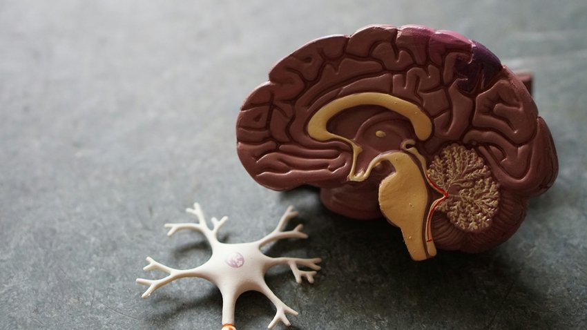 Sleep Deprivation Makes Your Brain Eat Itself Scientists Warn