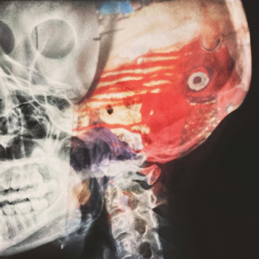 This Is What Happens to Your Brain When You Do not Sleep Enough