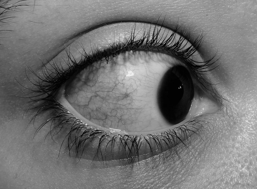 When to See a Doctor for Dry Eyes and What You Can Do at Home
