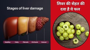 fatty liver, fatty liver symptoms, fatty liver precautions, Amla In Fatty Liver, tips for fatty liver patients, liver disease,