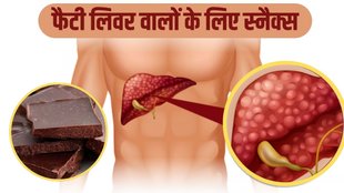 Fatty Liver Disease, boost liver health, Liver disease, fatty liver, Fatty liver supplements, Treatment for fatty liver