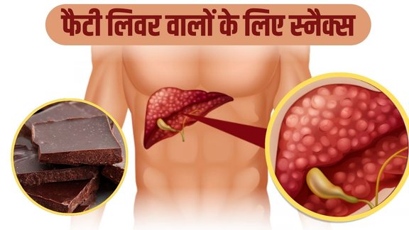 Fatty Liver Disease, boost liver health, Liver disease, fatty liver, Fatty liver supplements, Treatment for fatty liver