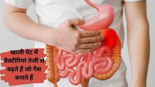 Bloating, bloating medical attention, persistent bloating, bloating and digestive issues, when bloating is serious, bloating with abdominal pain