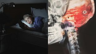 does sleep deprivation cause permanent brain damage