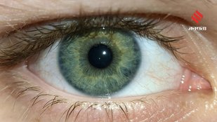 dry eyes home remedies