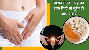 Foam in urine causes, foamy urine health risk, kidney disease symptoms, urine problems, serious health conditions, urinary health tips,