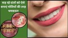 Remedies for whitening yellow teeth, what to apply to remove yellow layer on teeth, home remedies for whitening teeth, what foods to apply to teeth make teeth stronger