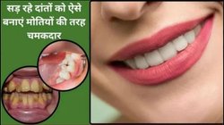 दांतों पर जमी पीली परत करनी है साफ, अपनाएं ये 3 घरेलू उपाय, मसूड़ों की सड़न भी होगी दूर