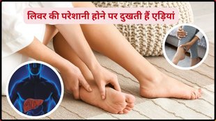 what are the signs of fatty liver,reverse fatty liver,liver health,liver damage symptoms,liver damage,liver,fatty liver, लिवर में परेशानी होने के लक्षण, लिवर में खराबी होने पर दिखने वाले लक्षण,
