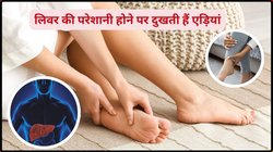 लिवर की परेशानी होने पर पैरों और पंजों में दिखते हैं ये 7 लक्षण, तुरंत समझे जिगर में खतरे के ये संकेत, डॉक्टर ने बताई पहचान
