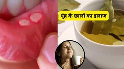 मुंह में बार-बार छाले आते हैं और जीभ पर बन जाती है सफेद परत, इन पत्तों के पानी से करें इलाज, आयुर्वेदिक एक्सपर्ट ने बताए 5 उपाय