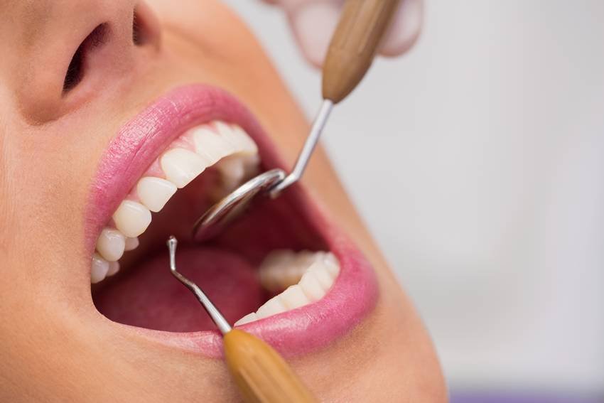 reduce plaque naturally