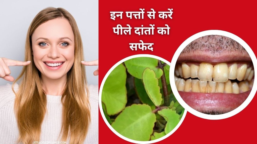 Tilchhatta for teeth whitening, Appa marg leaves for white teeth, Natural remedy for yellow teeth, Herbal toothpaste for teeth whitening,