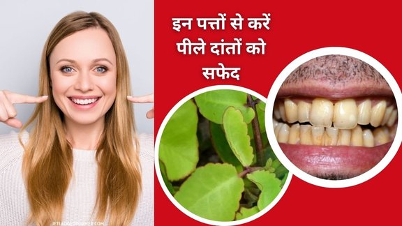 Tilchhatta for teeth whitening, Appa marg leaves for white teeth, Natural remedy for yellow teeth, Herbal toothpaste for teeth whitening,