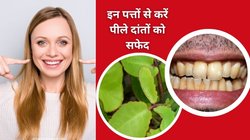 पीले दांतों से परेशान हैं? मसूड़ों में दर्द और कीड़ा भी सताता है तो इस 1 पत्ते को चबा लें, दांतों में ठंडा-गर्म लगना और पीलापन होगा दूर