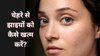 चेहरे से झाइयां को दूर करने के लिए करें ये 3 काम, डर्मेटोलॉजिस्ट ने बताया पिग्मेंटेशन को ठीक करने के आसान तरीके