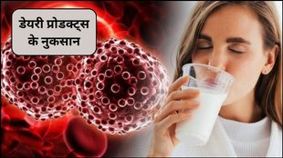 dairy consumption, prostate cancer, cancer risk, inflammatory food, Dr Sharmin Yaqin, cancer specialist, dairy products ke nuksan