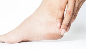 Vitamin deficiency for cracked heels