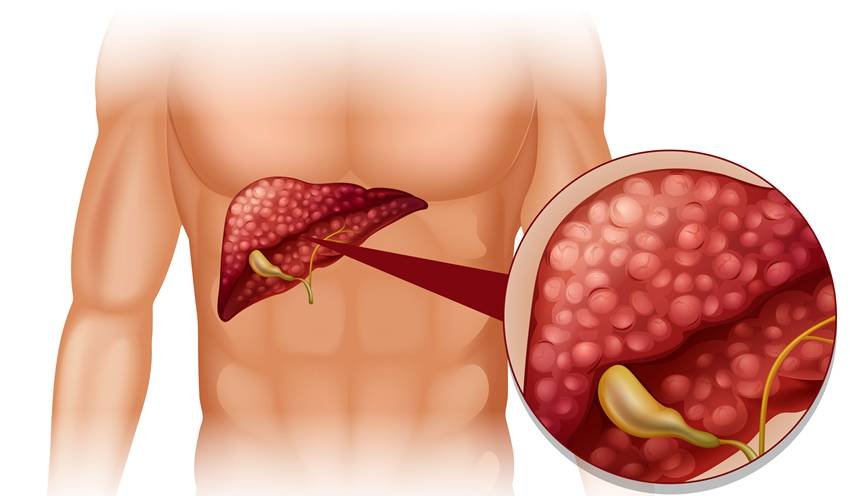 health benefits of post-meal walk