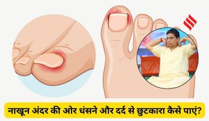 Ingrown Nail Treatment by Acharya Balkrishna