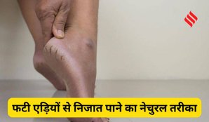 Cracked heels natural remedies