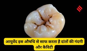 Ayurvedic remedy for teeth
