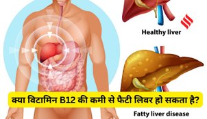 Vitamin B12 deficiency