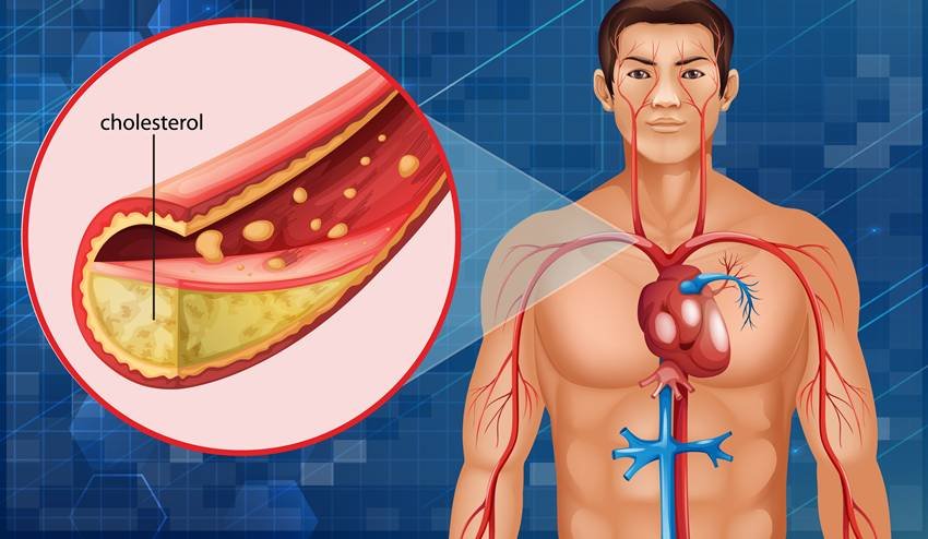 natural remedy for high BP