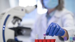 डिप्लोमा इन मेडिकल लैब टेक्नोलॉजी (DMLT) में बनाएं शानदार करियर, यहां देखें कोर्स से जुड़ी हर जानकारी