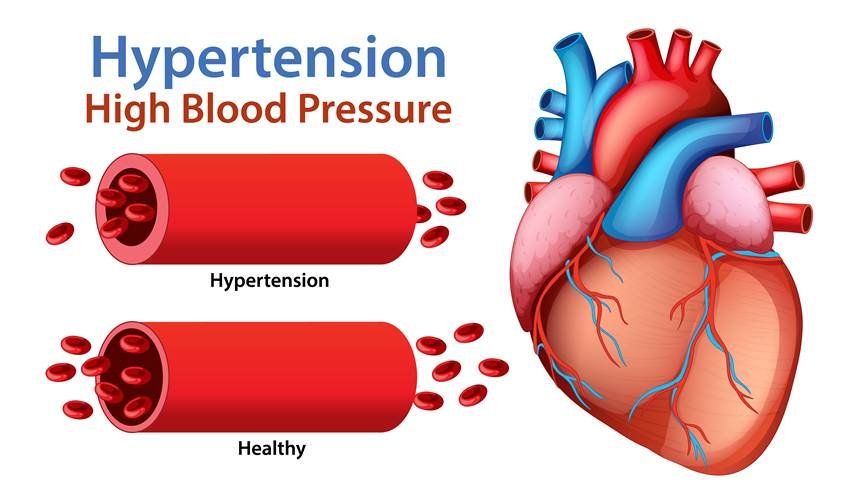early high blood pressure symptoms in men