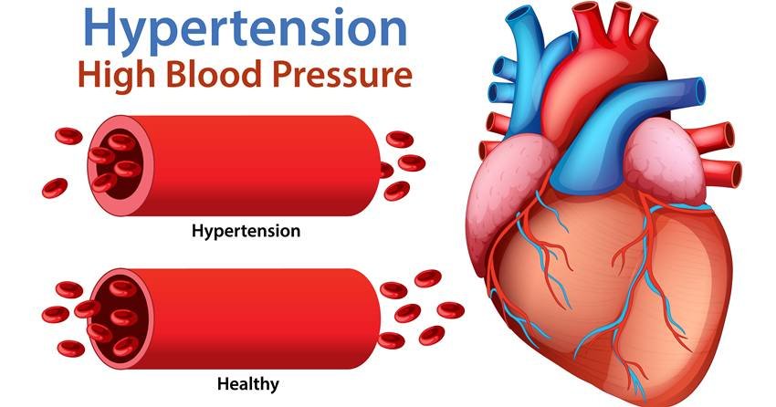 Early signs of heart disease