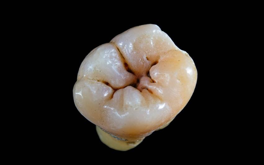 Natural remedy to clean teeth