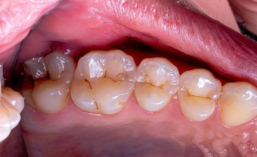 Homemade Ayurvedic tooth powder