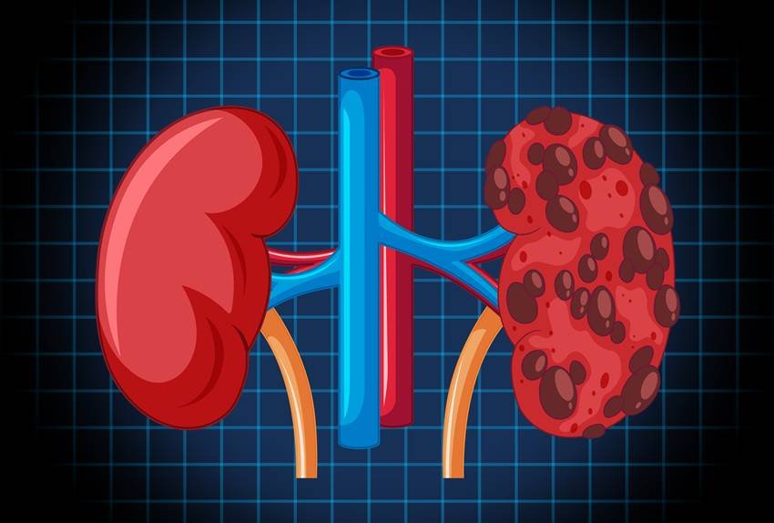 habits that harm kidneys