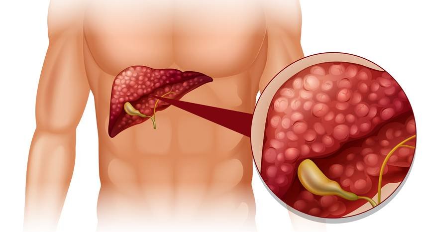 how to reduce liver fat naturally