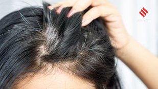 Natural Solutions to Grey Hair Try These 5 Ayurvedic Herbs