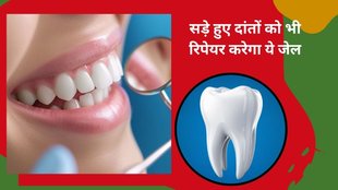 tooth decay treatment, enamel repair gel, new dental innovation, sensitive teeth solution, tooth enamel regeneration, Prof Alvaro Mata research