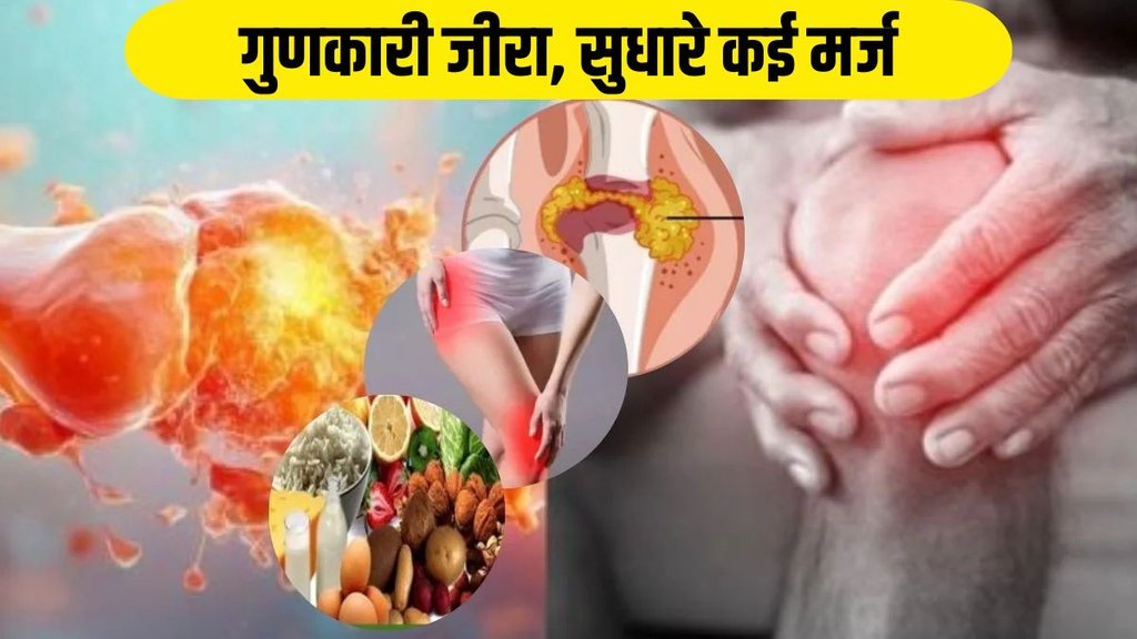 Reduce Uric Acid, Home Remedies to Reduce Uric Acid, Uric Acid treatment Reduce Uric Acid, Home Remedies to Reduce Uric Acid, Uric Acid treatment