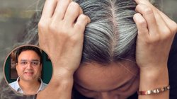 इन 2 चीजों से सफेद बाल जड़ से होंगे काले, एक्सपर्ट सलीम जैदी ने बताया आसान तरीका