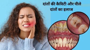 turmeric for teeth whitening, how to whiten teeth naturally with turmeric, hansa ji ayurvedic tips for teeth, turmeric and coconut oil for teeth, remove yellow stains from teeth naturally,