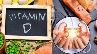 Vitamin D overdose symptoms,Vitamin D kidney damage,Vitamin D intake recommendations,Signs of kidney damage from vitamin D,